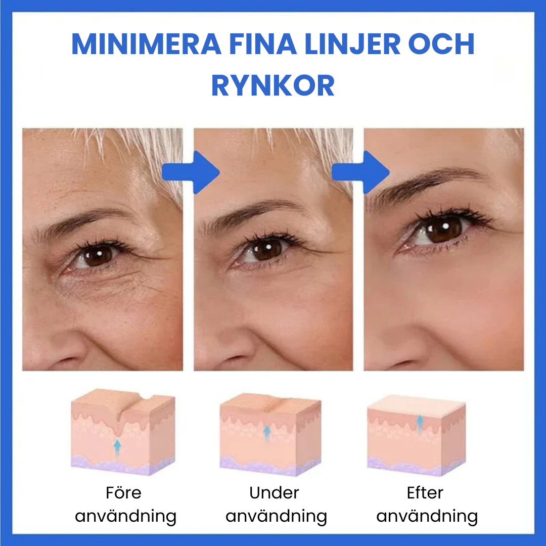 SkinLift™ - Botox Ansiktsserum