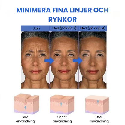 SkinLift™ - Botox Ansiktsserum