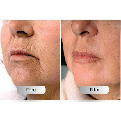 SkinLift™ - Botox Ansiktsserum